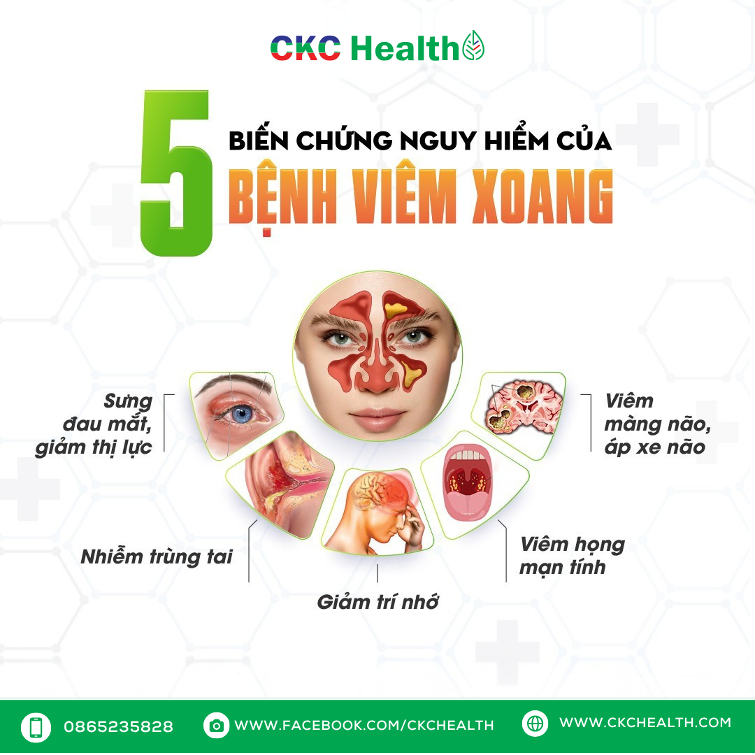 TRỜI LẠNH–CẢNH GIÁC BIẾN CHỨNG NGUY HIỂM CỦA VIÊM MŨI XOANG!